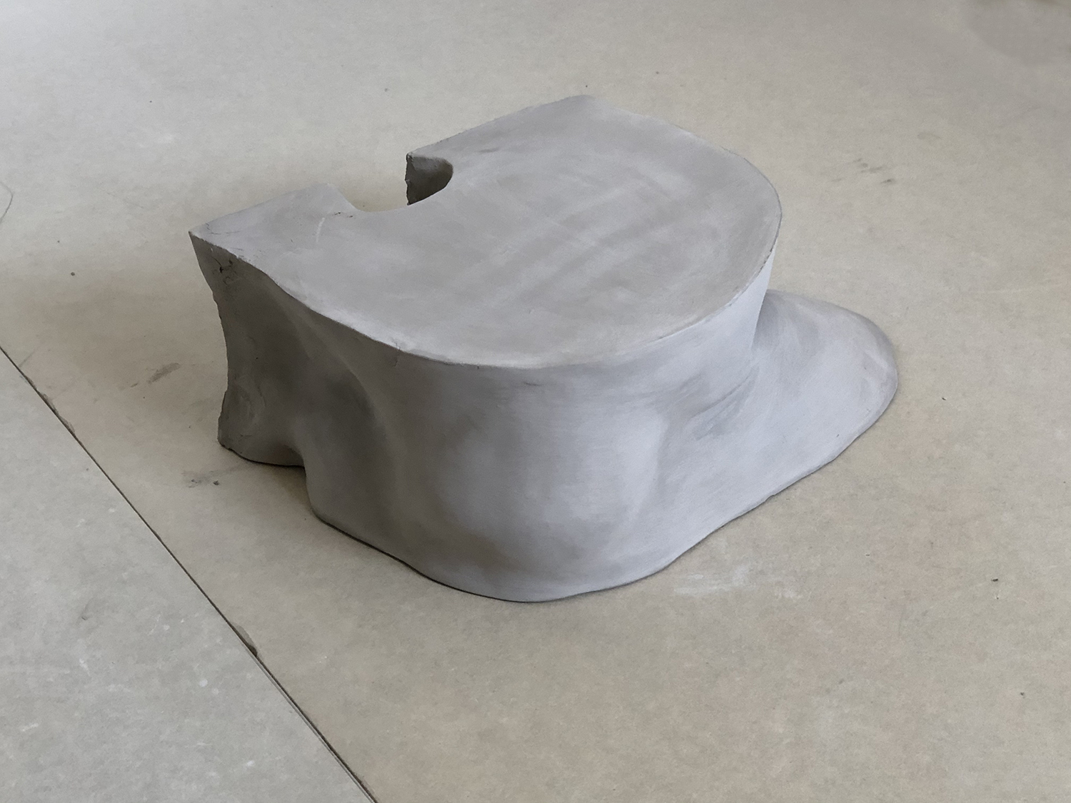 Iliac_4