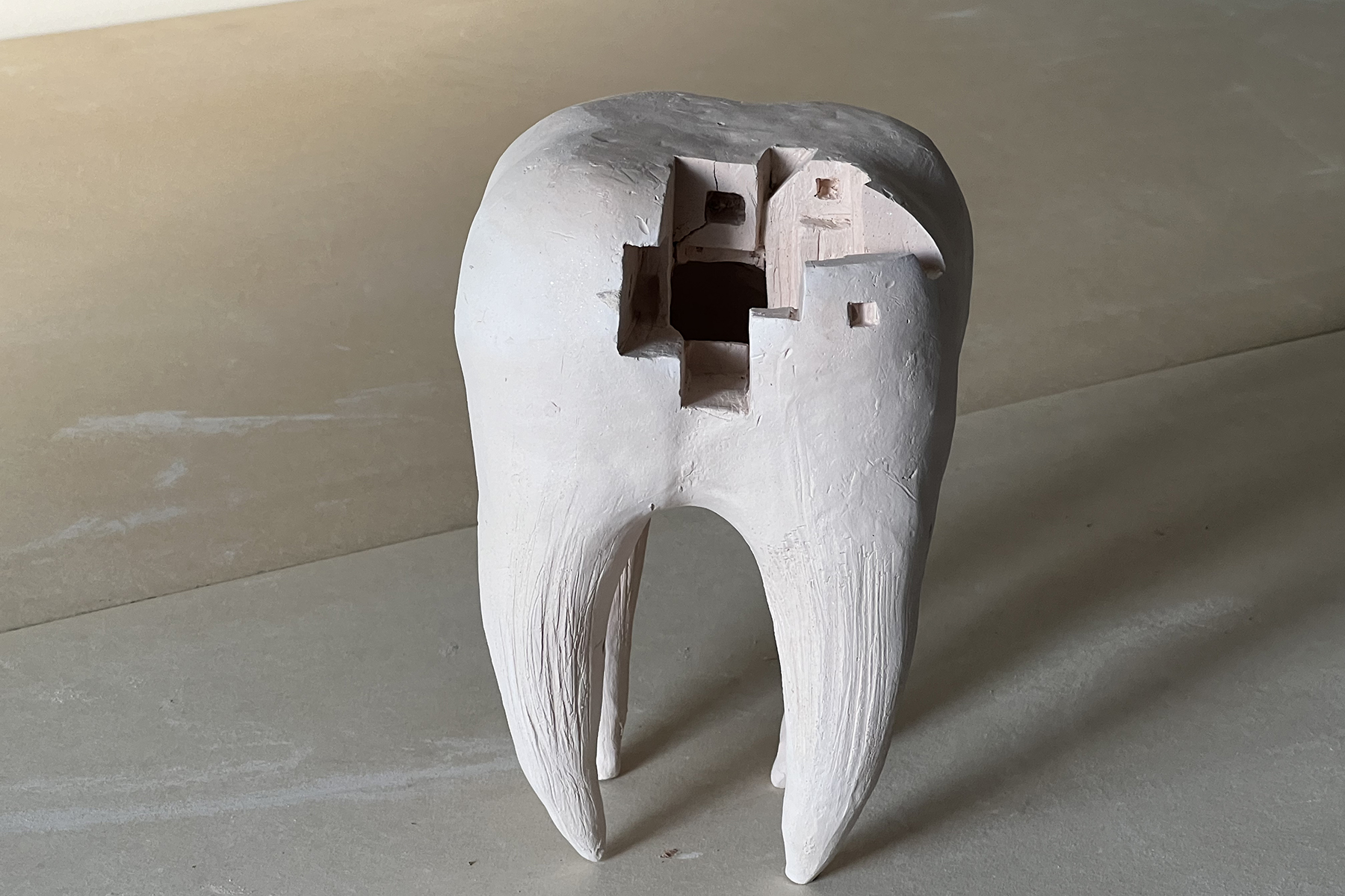 dente 02