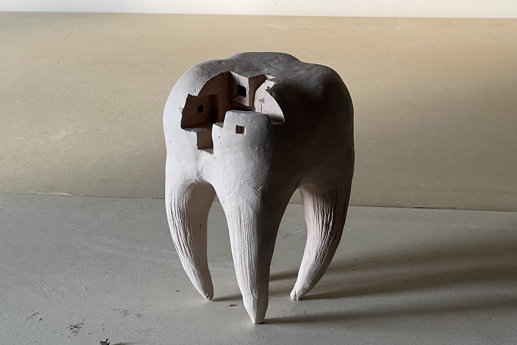dente 04